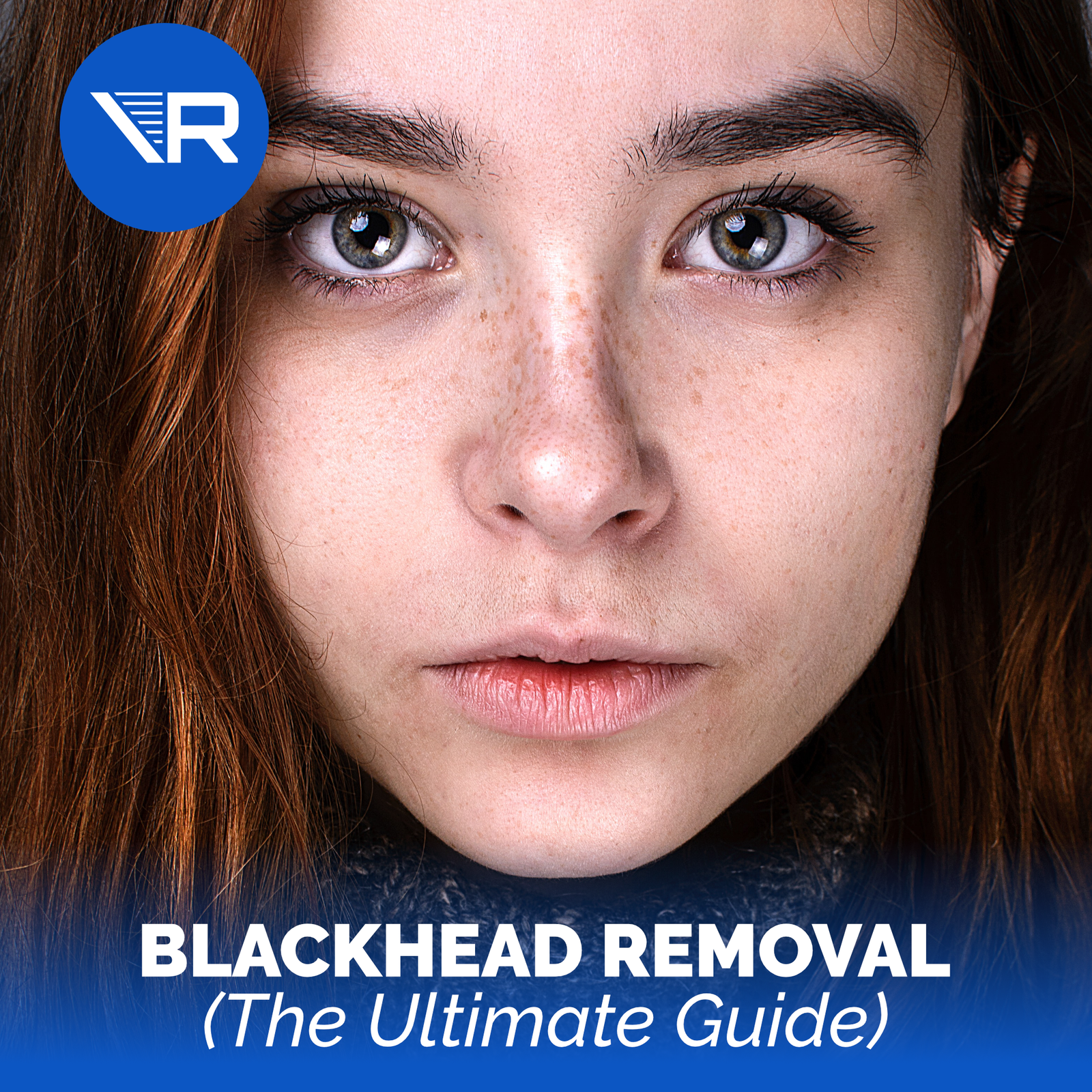 blackheads removal