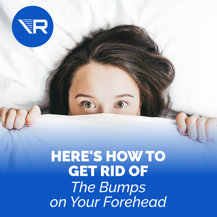 Bumps on Forehead: Here's How to Get Rid of Them (The Smart Way)