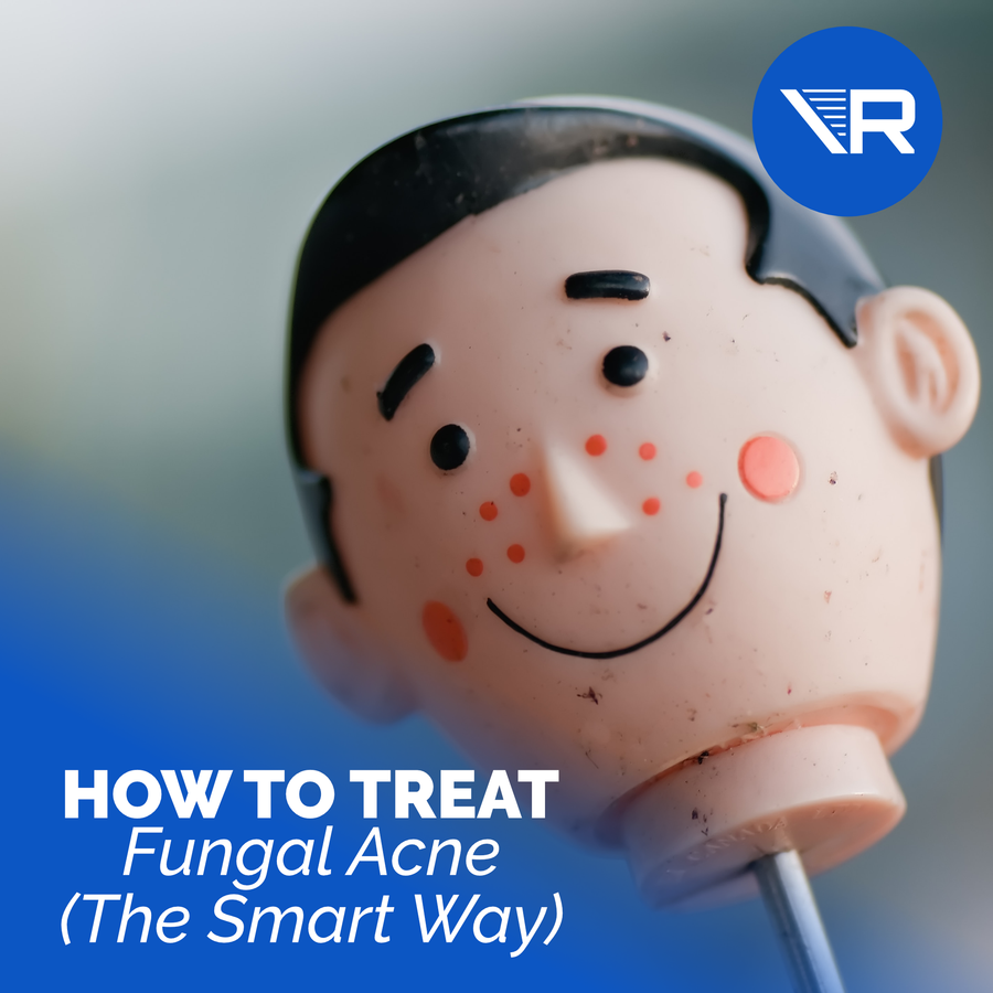 What is Fungal Acne, and How Do I Treat It?