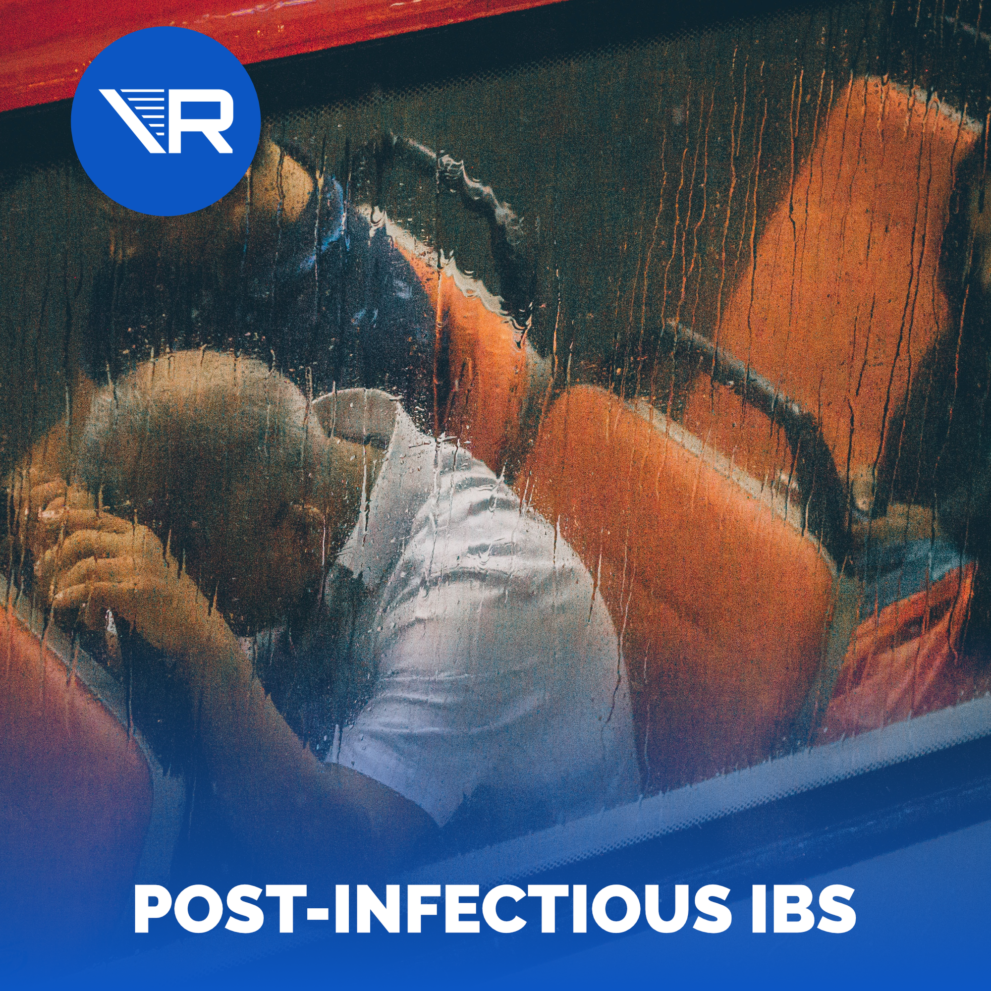 Post-Infectious IBS