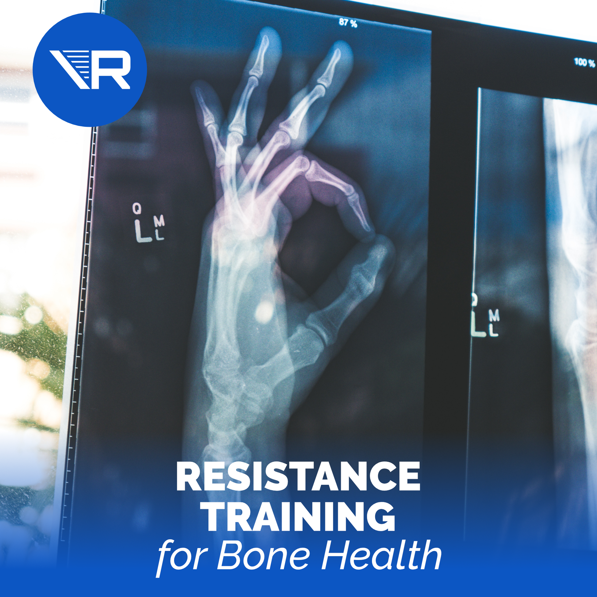 Resistance Exercise for Bone Health