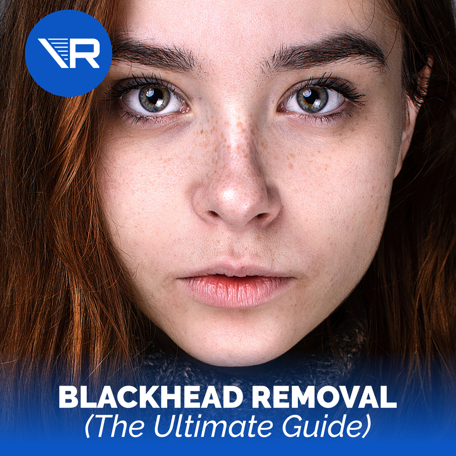 The Ultimate Guide to Blackheads Removal